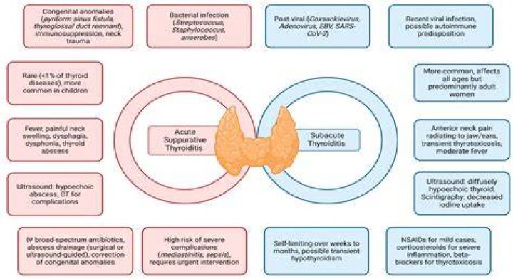 How long does subacute thyroiditis last?