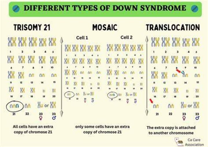 When do trisomies occur?